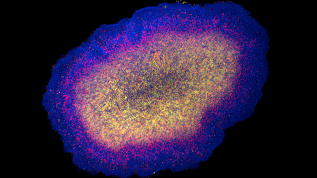 Una antigua criatura marina del tamaño de un grano de arena podría revelar el origen de las neuronas Una antigua criatura marina del tamaño de un grano de arena podría revelar el origen de las neuronas