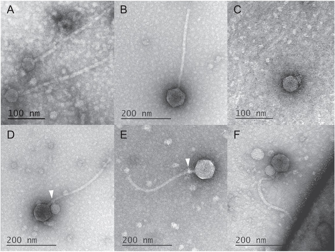 Observan por primera vez un virus adherido a otro Observan por primera vez un virus adherido a otro